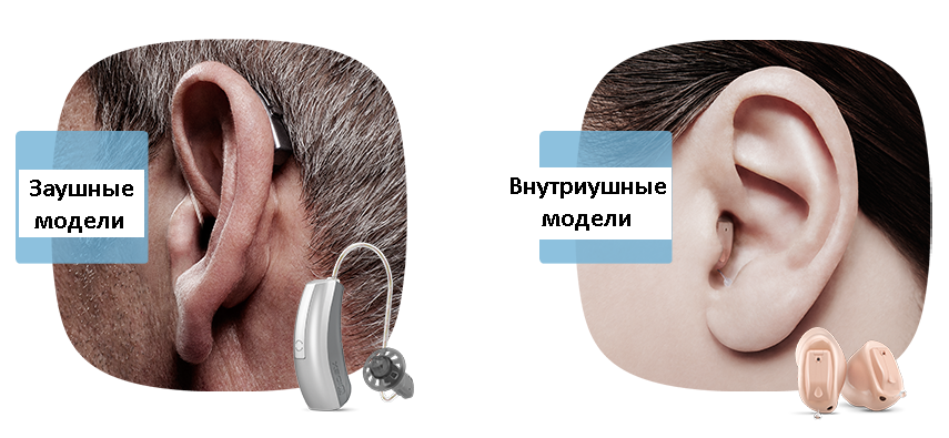 Компенсация слуховых аппаратов 